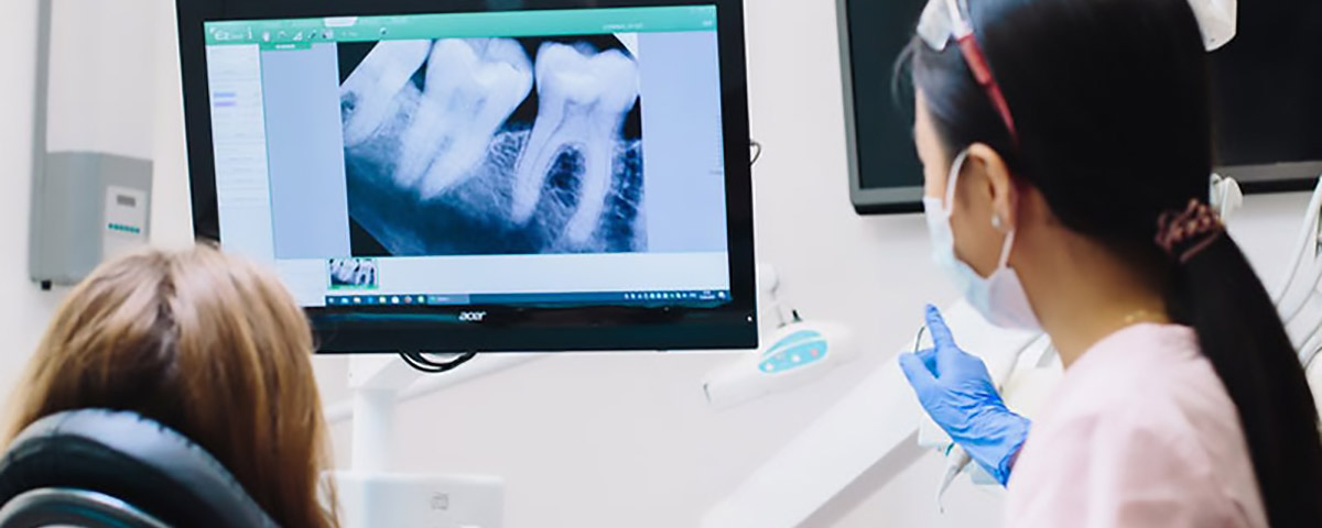Che cos'è l'endodonzia e come funziona?