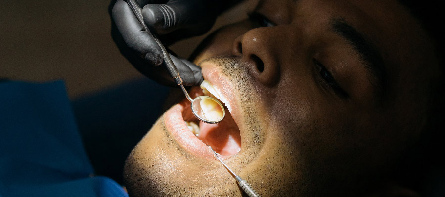 Carie dentali: cause e rimedi