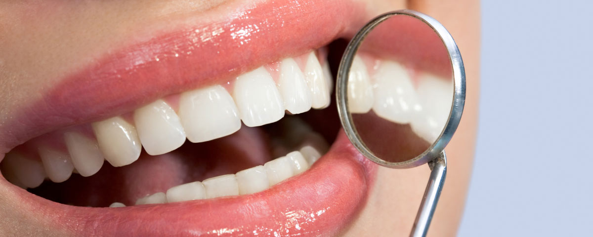 I tuoi denti sono piccoli o corti? Ecco le cause e i rimedi