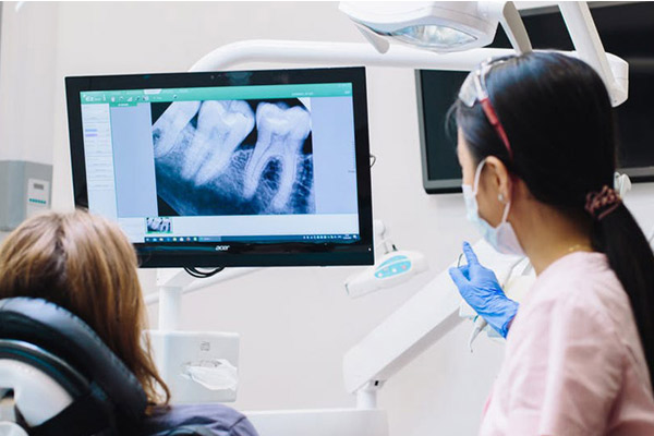 Che cos'è l'endodonzia e come funziona?