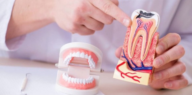 endodonzia e devitalizzazione denti a Cagliari