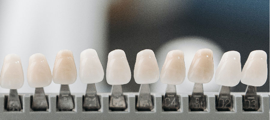 L'implantologia dentale è dolorosa?