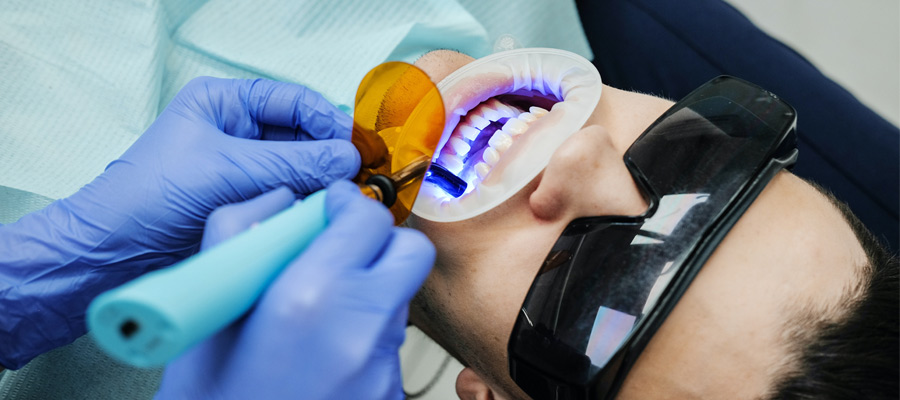 Laser e parodontologia: come funziona e a cosa serve