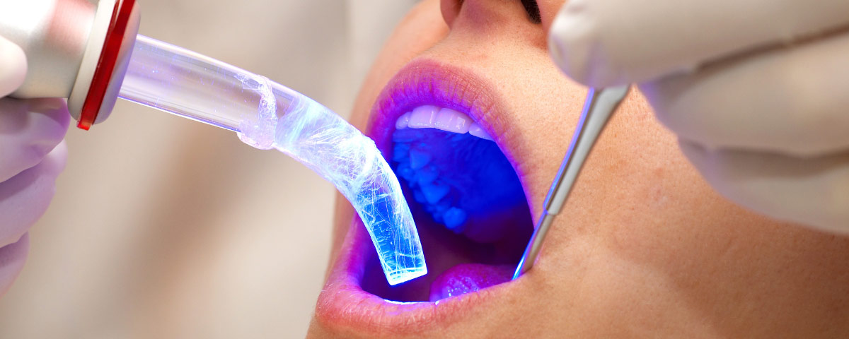 Come viene utilizzato il laser in odontoiatria?